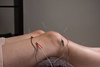 Acupuncture Colchester 727141 Image 1